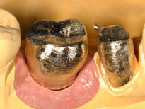 Gold01 Implantataufbau