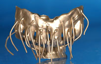 Gold03 Implantataufbau